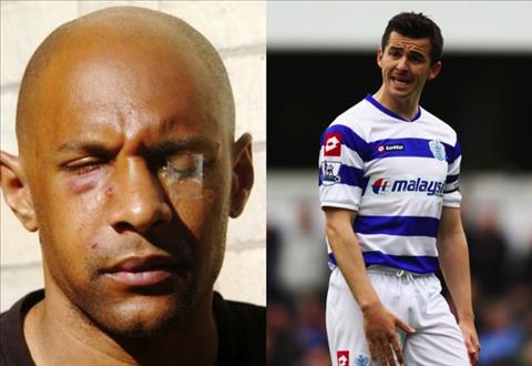 Idrissa Gueye vs Michael Keane và những vụ gà nhà đá nhau tai tiếng trên sân cỏ 5